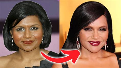 mindy kaling plastic surgery|Mindy Kaling Plastic Surgery: Comparison of Before & After ...